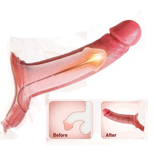 DragonSkin™ Textured Condoms (sillicon condoms)